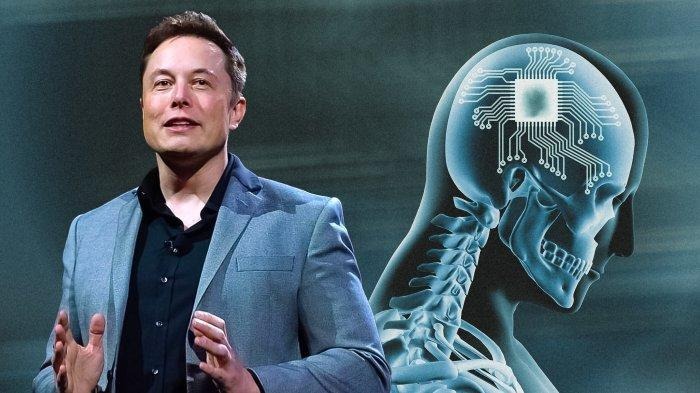 Moscow: Individu kedua telah berjaya menerima implan daripada Neuralink dan prosedur tersebut berjaya, umum bilionair Amerika Syarikat, Elon Musk.